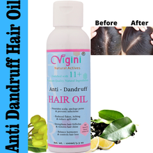 Vigini Anti-Dandruff Hair Oil