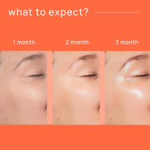 Nyumi Radiant Skin Gummies For Glowing Skin - Juicy Orange Flavour